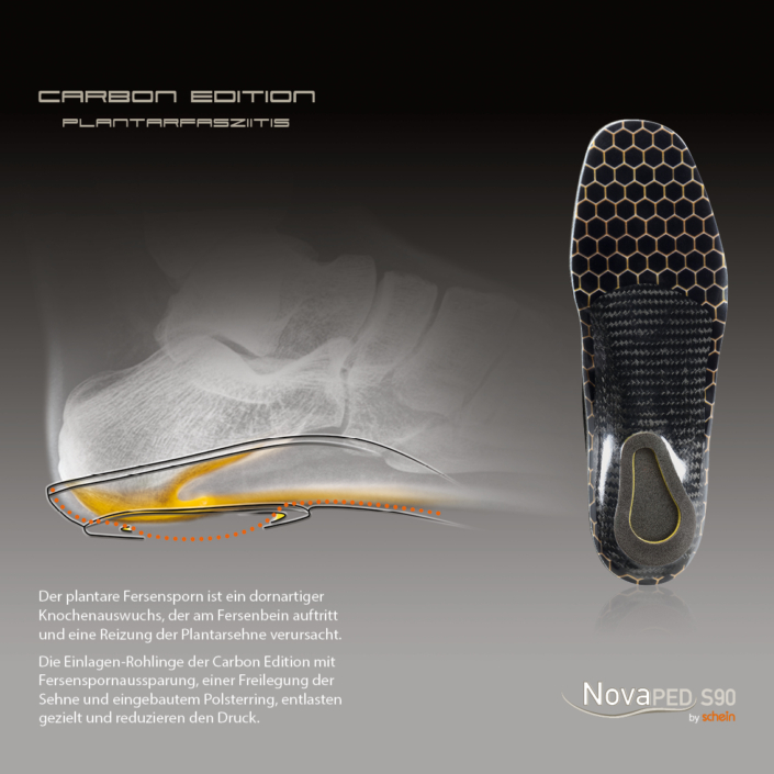 Schein Novaped Carbon Edition